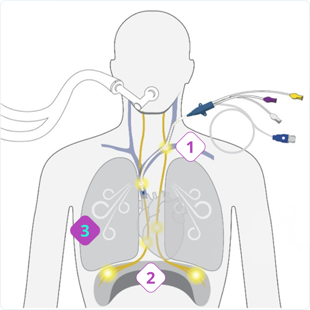 Interactive-Diagram-3